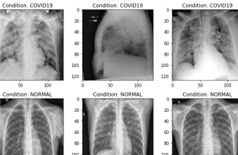 covid19-classification-data-sample.jpg